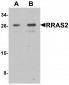 RRAS2 Antibody