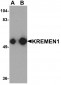 KREMEN1 Antibody