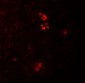 PRKCDBP Antibody