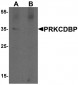 PRKCDBP Antibody