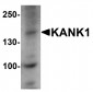 KANK1 Antibody