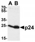 HIV-1 p24 Antibody