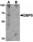 GBP5 Antibody