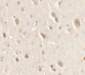 ULK1 Antibody