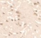 ULK2 Antibody