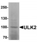 ULK2 Antibody