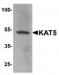 KAT5 Antibody
