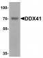 DDX41 Antibody