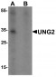 UNG2 Antibody