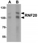 RNF20 Antibody