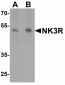 GABARAP Antibody