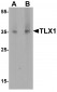 TLX1 Antibody