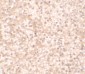 IL-17RA Antibody