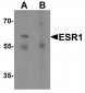 ESR1 Antibody