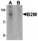 B2M Antibody