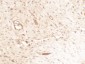 SPP1 Antibody