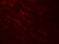 KLK4 Antibody 