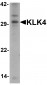 KLK4 Antibody 