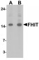 FHIT Antibody 