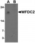 WFDC2 Antibody 
