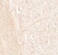 ERAP1 Antibody 