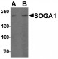SOGA1 Antibody 