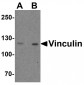 Vinculin Antibody 