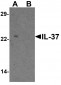 IL-37 Antibody 