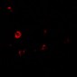 IL-1RL2 Antibody