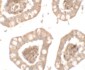 IL-1RL2 Antibody