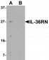 IL-36RN Antibody