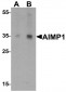 AIMP1 Antibody