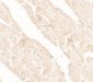 AIMP2 Antibody