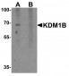 KDM1B Antibody