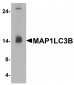 MAP1LC3B Antibody