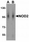 RPSA Antibody