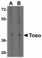 RPSA Antibody