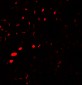 AQP2 Antibody