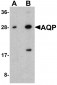 AQP2 Antibody