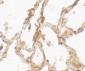 TRPV4 Antibody