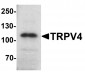 TRPV4 Antibody