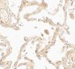 SUZ12 Antibody