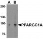 PPARGC1A Antibody