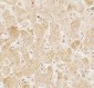 LAMTOR2 Antibody