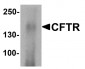 CFTR Antibody