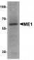 ME1 Antibody