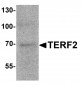 TERF2 Antibody
