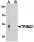 TRIM21 Antibody