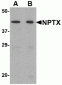 OLIG2 Antibody