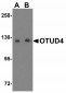 SMARCA4 Antibody